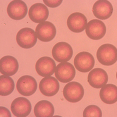 Gel Permeation Chromatography��GPC��Media